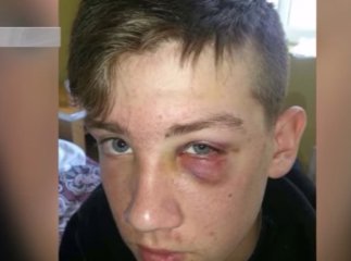 Шкільні розбірки в Ужгороді завершились скандалом