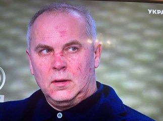 Нардеп із Закарпаття Нестор Шуфрич і відомий журналіст жорстко побилися у прямому ефірі