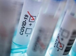 Минулої доби померла ще одна людина, інфікована коронавірусом