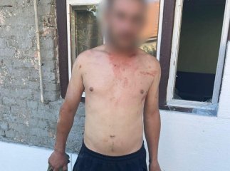 Закарпатець ледь не вбив співмешканця своєї сестри: потерпілий у реанімації