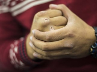 Бійка у Мукачеві: потерпілі отримали множинні ушкодження