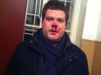 Нардепа від "Свободи" і його адвоката побили прямо біля райвідділу міліції (ФОТО)
