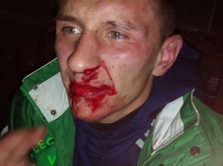 Після нічного забігу в Ужгороді невідомі побили одного із організаторів "Night Run" (ФОТО)