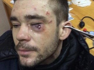 В результаті побоїв у центрі Києва госпіталізовано 42 людини