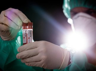 Закарпаття побило власний антирекорд по кількості хворих на COVID-19 за добу