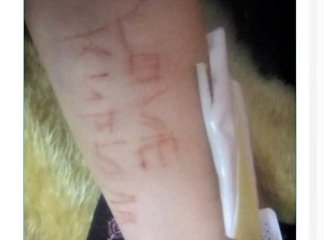 Небезпечна інтернет-гра: 11-річна закарпатка ледь не вчинила самогубство