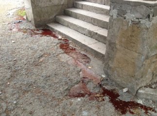 Ужгородець впав із четвертого поверху, за його життя борються лікарі