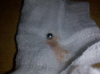 У Мукачеві 16-річний хлопець вистрелив у голову 14-річному