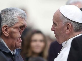 Щоб благословити чоловіка з деформованим обличчям Папа Римський перервав проповідь (ФОТО)