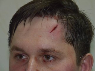 У мережі з’явилось фото сьогоднішнього побиття заступника начальника Мукачівського військового шпиталю (ФОТО)
