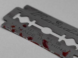 У Міжгір’ї посеред вулиці 15-річна дівчина порізала собі вени