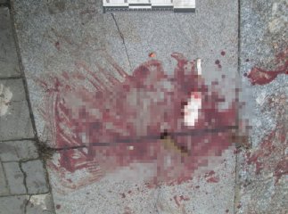 В Ужгороді вночі сталась стрілянина, внаслідок якої постраждав житель Мукачівщини