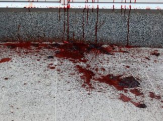 Неподалік "Зеленого ринку" у Мукачеві чоловік стік кров’ю