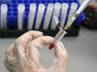 В Ужгороді різко зросла захворюваність на гепатит А: двох школярів госпіталізували