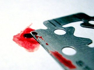 Закарпатець вчинив самогубство перерізавши собі вени