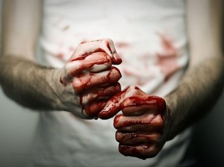 Психічнохворий чоловік убив людину