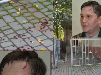 Одним з учасників бійки поблизу Мукачівського військового шпиталю був кандидат в народні депутати по округу №69