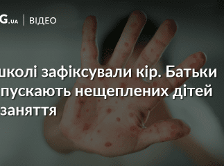 Кір у школі: нещеплені діти не ходять на заняття