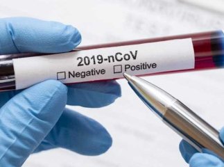 В області зменшується добова кількість нових інфікувань коронавірусом 