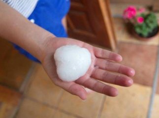 Град був настільки сильним, що "поклав" на лікарняні ліжка 7 людей, одній жінці розтрощив руку