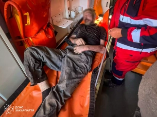 Чоловік травмувався під час пожежі: місцеві помітили дим і викликали рятувальників
