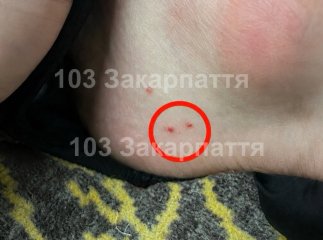 У Тячівському районі чоловіка госпіталізували після укусу отруйної змії