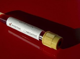 Перший випадок коронавірусу на Закарпатті: у Мукачеві в жінки виявили COVID-19