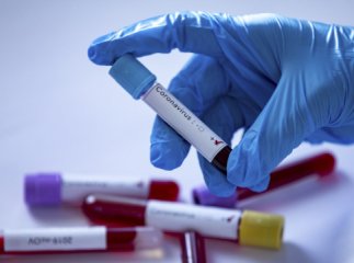 Кінець жовтня-початок листопада: лікарі озвучили невтішні прогнози