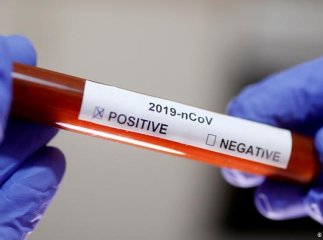 Хворих на коронавірус в Україні побільшало: відомо, в якій області зафіксовано новий випадок COVID-19