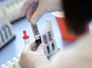 У Словаччині засумнівались в ефективності масового тестування на коронавірус