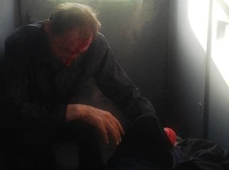 Бiля Сваляви пасажир потягу розбив головою вікно