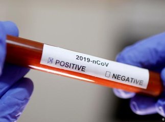 Через постійний ріст хворих, вчені розповіли про нові симптоми коронавірусу, на які варто звернути увагу