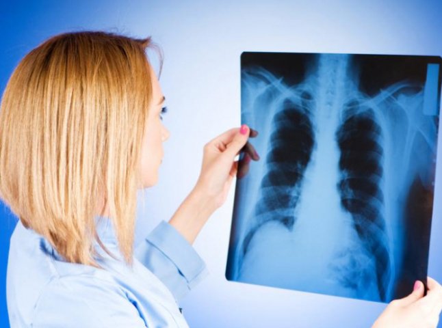 В Ужгороді цього року вже виявили 14 хворих на туберкульоз