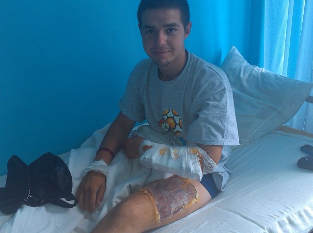 Прикордонник із Мукачева пережив операцію з пересадки шкіри (ФОТО)