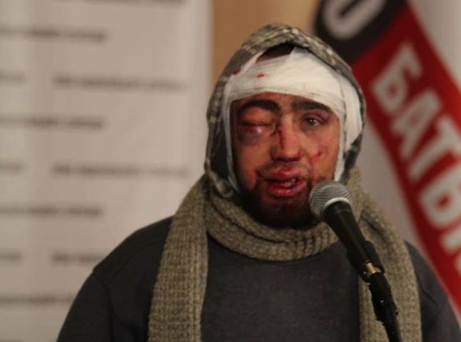 Страшні подробиці побиття людей на Євромайдані: спочатку бив "Беркут", як набридло, передав на знущання ВВешникам