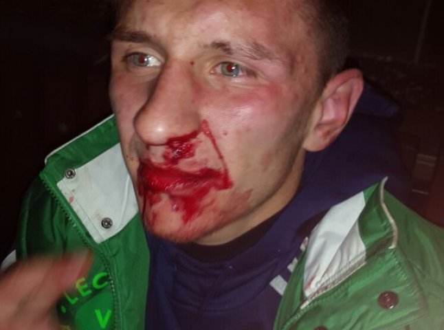Після нічного забігу в Ужгороді невідомі побили одного із організаторів "Night Run" (ФОТО)