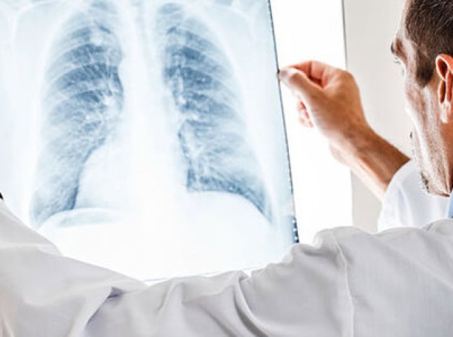 В області продовжує зростати захворюваність на туберкульоз
