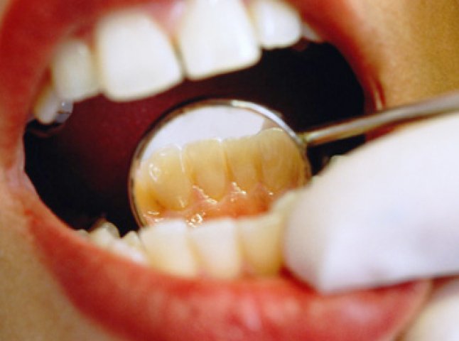 Медичний скандал: стоматолог виявився вандалом
