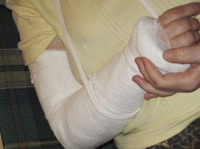 П’яний хуліган з Ільниці зламав міліціонеру руку