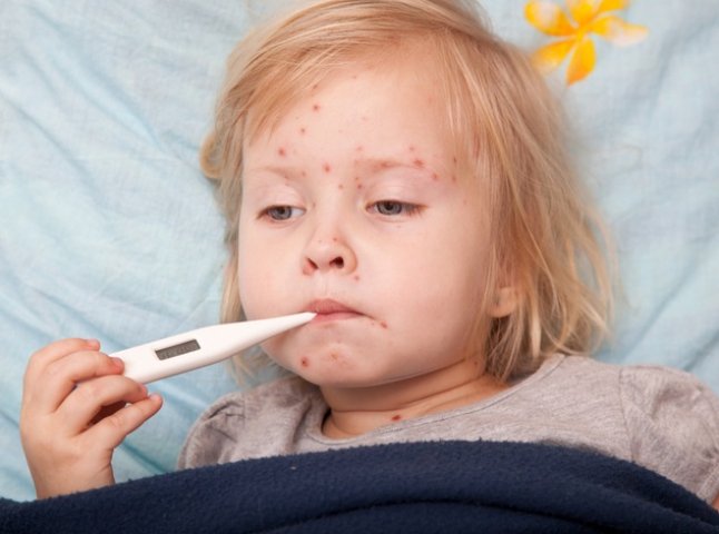 Закарпаттям шириться кір. Лікарі закликають батьків вакцинувати дітей