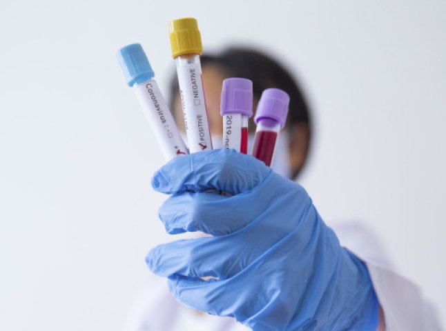Українців масово тестують на антитіла до COVID-19