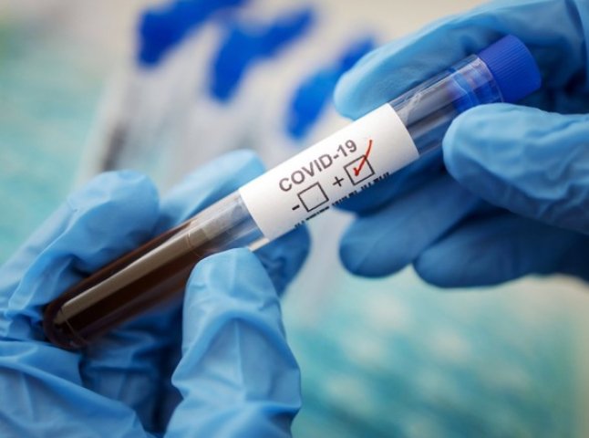 За добу в області виявили 67 хворих на COVID-19