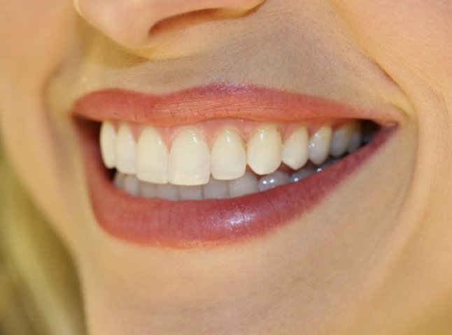 Білосніжна усмішка – свідчення здоров’я ?