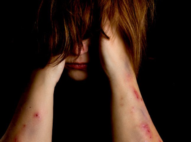 Звіряче згвалтування на Ужгородщині: хлопець напав на жінку, пограбував, наглумився над нею та ледь не вбив