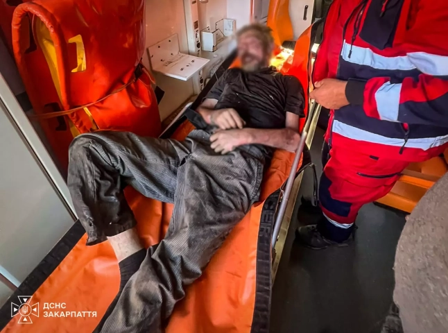 Чоловік травмувався під час пожежі: місцеві помітили дим і викликали рятувальників