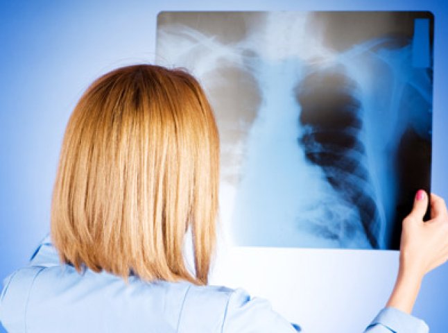 Хустська лікарка взяла гроші у добровольця за рентгенівський знімок