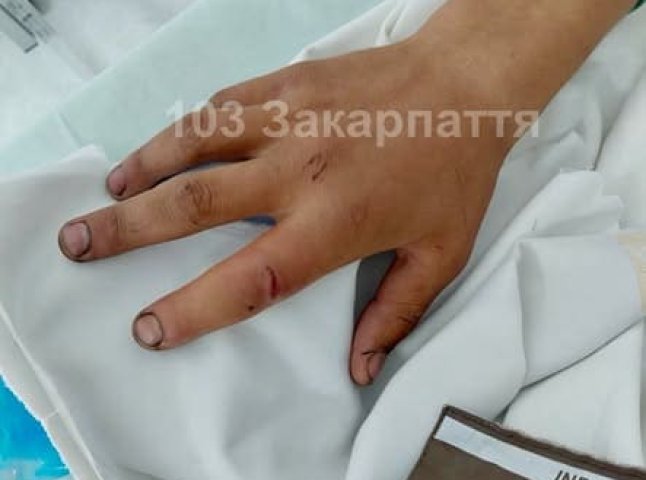 Змії атакують: новий випадок із госпіталізацією на Мукачівщині