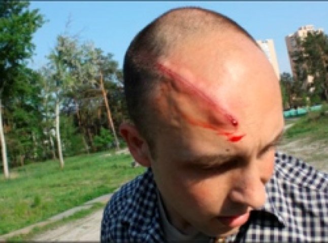 Журналісту розбили голову під час акції протесту в Києві