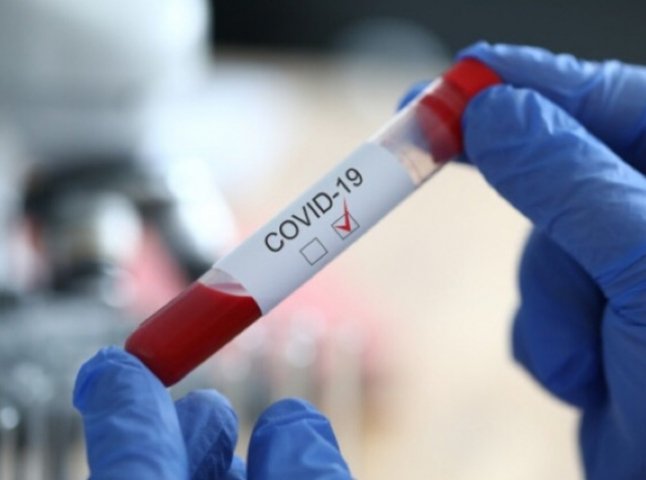 80 нових хворих на COVID-19 та 5 смертей за добу: оновлені дані