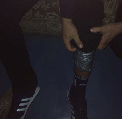 Собака знайшла у чоловіка наркотики, які той примотав скотчем до тіла – 01